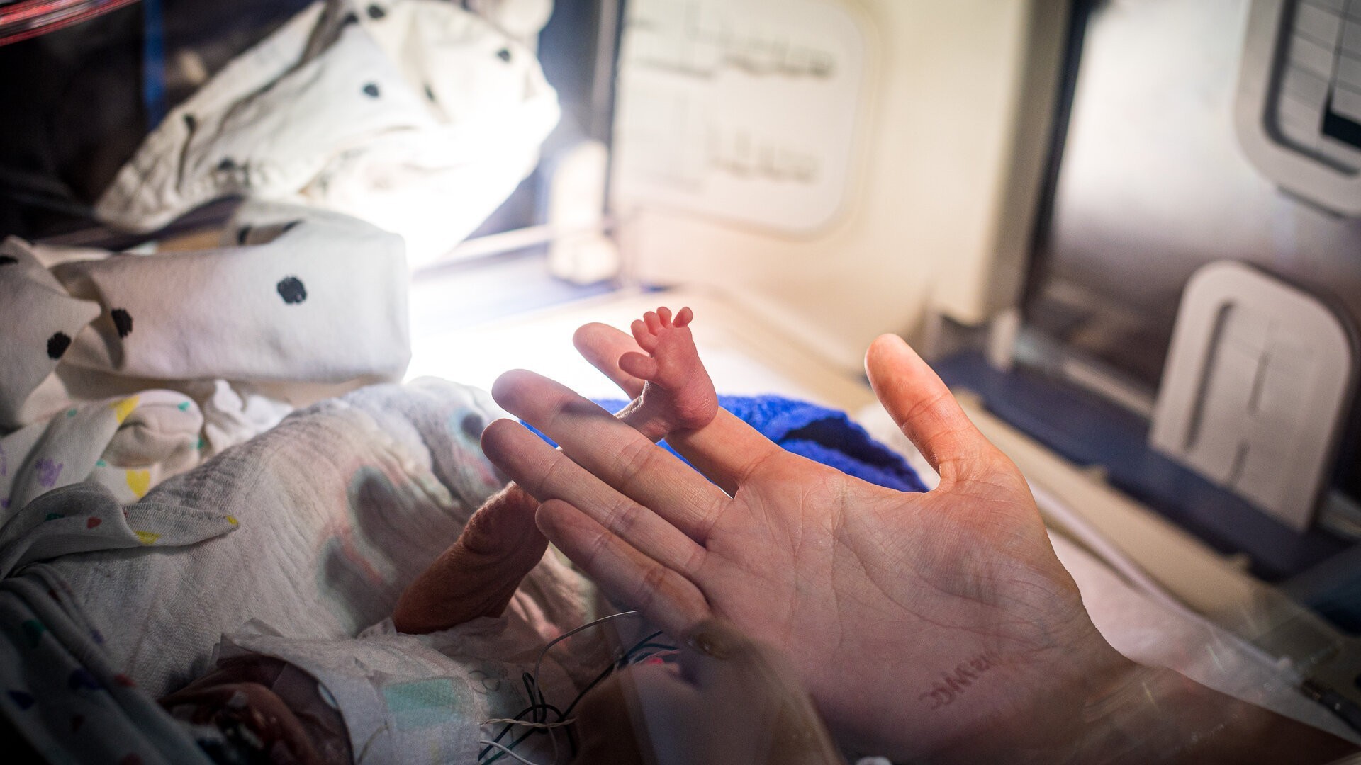 Een Stoma Voor Kleine Ace In Handen Aan De Couveuse TVgids Nl