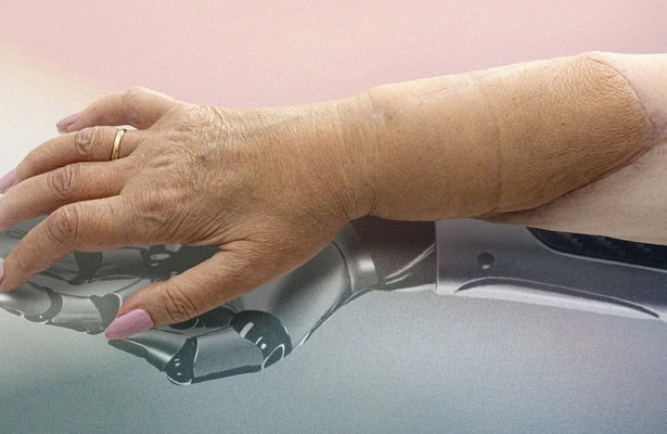 Die neue Hand - Geschichte einer Transplantation
