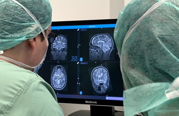 Gehirn unter Strom: Hilfe bei Depression, Epilepsie und Parkinson?