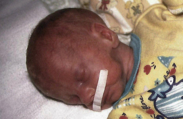 Ich bin ein Frühchen