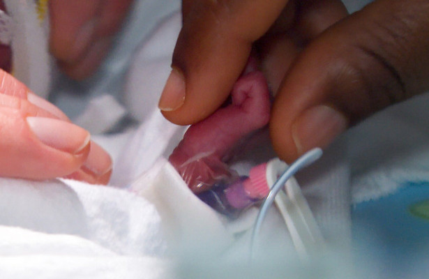 Kleines Leben - große Sorgen: Auf der Frühchenstation