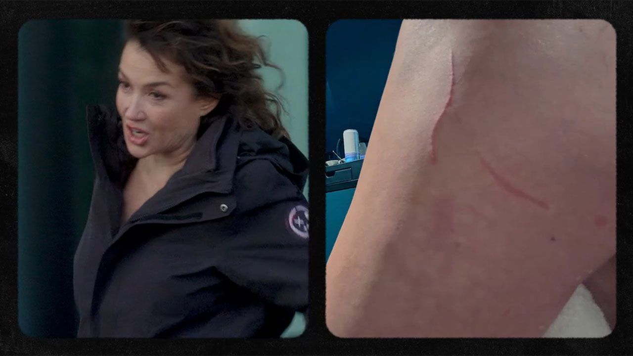 Katja Schuurman laat de krassen op haar lichaam zien in De Drop