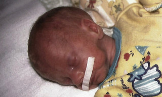 Ich bin ein Frühchen