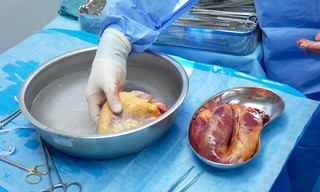 Warten auf ein neues Herz - Patienten, Transplantationsärzte und der Faktor Zeit