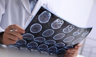 Diagnose Multiple Sklerose