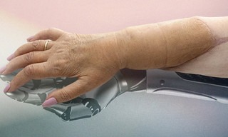 Die neue Hand - Geschichte einer Transplantation