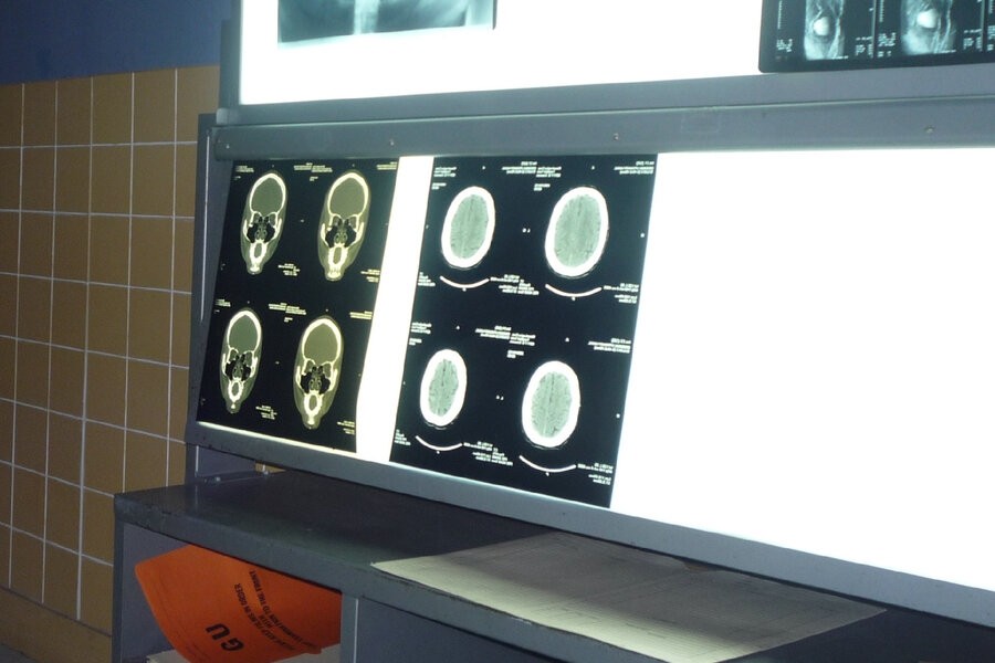 I didn't know I was pregnant