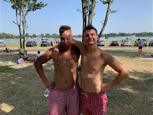 Zeldzaam syndroom in Je zal het maar hebben