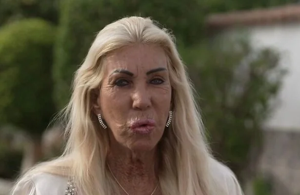 Caroline uit B&B Vol Liefde