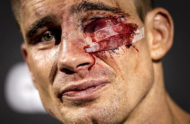 Rico Verhoeven