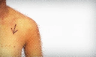Breast cancer scandal: Exposing the harm