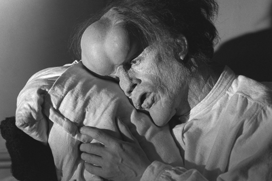 The Elephant Man